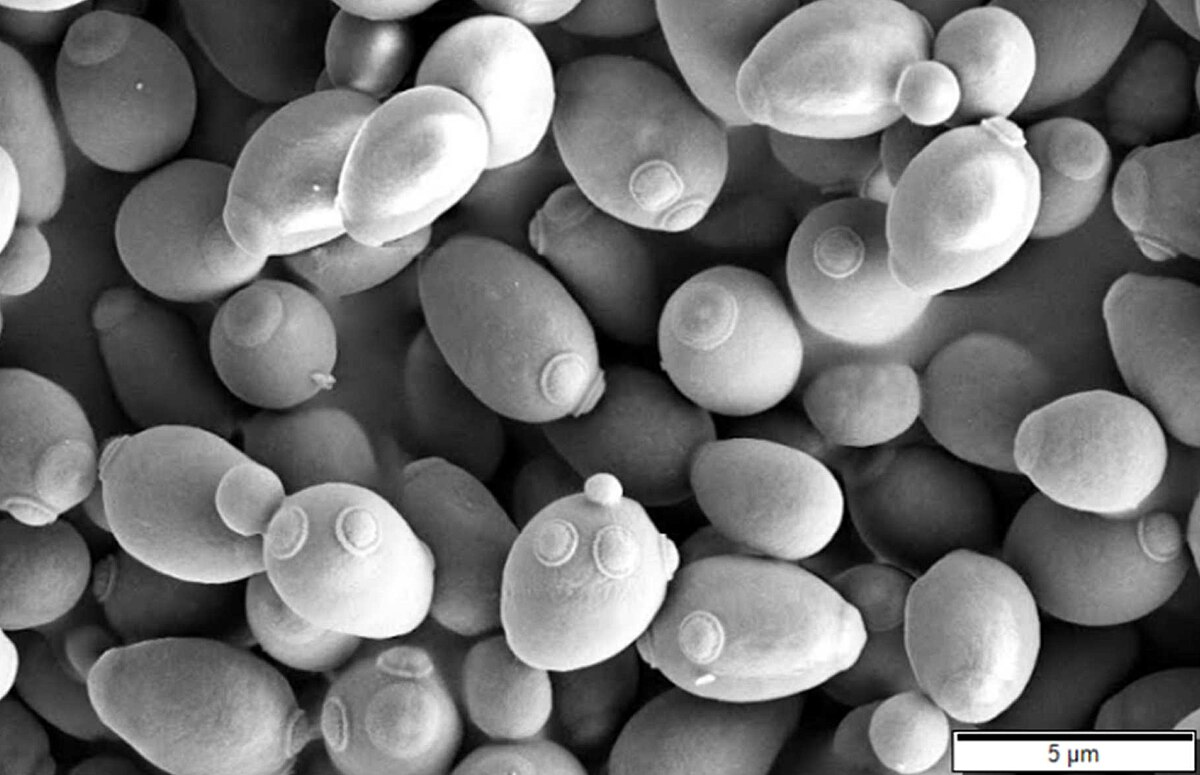 Фотка с электронного микроскопа колонии Saccharomyces cerevisiae. Видны выросты, из которых формируются новые клетки. 